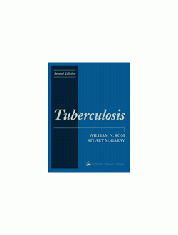 Tuberculosis