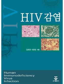 HIV감염