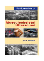 Fundamentals of Musculoskeletal Ultrasound ,1/e