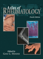 Atlas of Rheumatology, 4/e