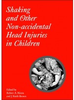 Shaking and Other Non-Accidental Head Injuries in Children