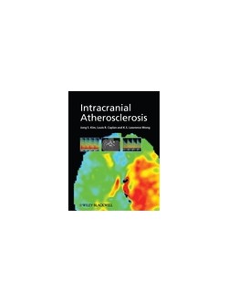 Intracranial Atherosclerosis