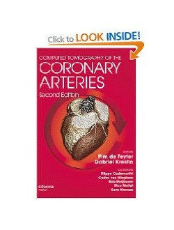 Computed Tomography of the Coronary Arteries