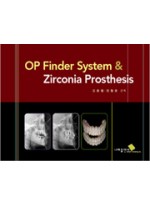 OP Finder System & Zirconia Prosthesis