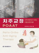 치주교정 POAAT - 치주전문의가 하는 치열교정
