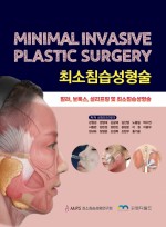 최소침습성형술(Minimal Invasive Plastic Surgery)