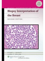 Biopsy Interpretation of the Breast, 2/e