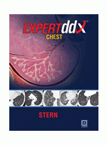 Expert Differential Diagnoses: Chest