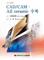 CAD CAM All ceramic 수복(시스템별)