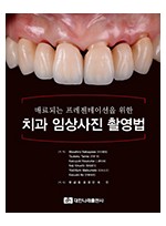 매료되는 프레젠테이션을 위한 치과 임상사진 촬영법