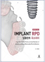 허중보의 Q&A 임플란트 국소의치 (Implant RPD)