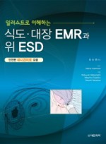 일러스트로 이해하는 식도 대장 EMR과 위 ESD 안전한 내시경치료 요령 양장본  