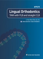 Lingual Orthodontics -TAM with FLB and straight CLB (설측교정)  