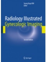 Radiology Illustrated: Gynecologic Imaging, 2/e