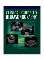 Clinical Guide to Ultrasonography 