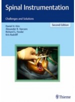 Spinal Instrumentation: Challenges and Solutions, 2/e 