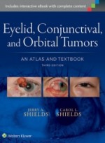 Eyelid, Conjunctival, and Orbital Tumors: An Atlas and Textbook 