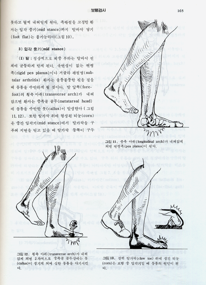 척추와사지의검진