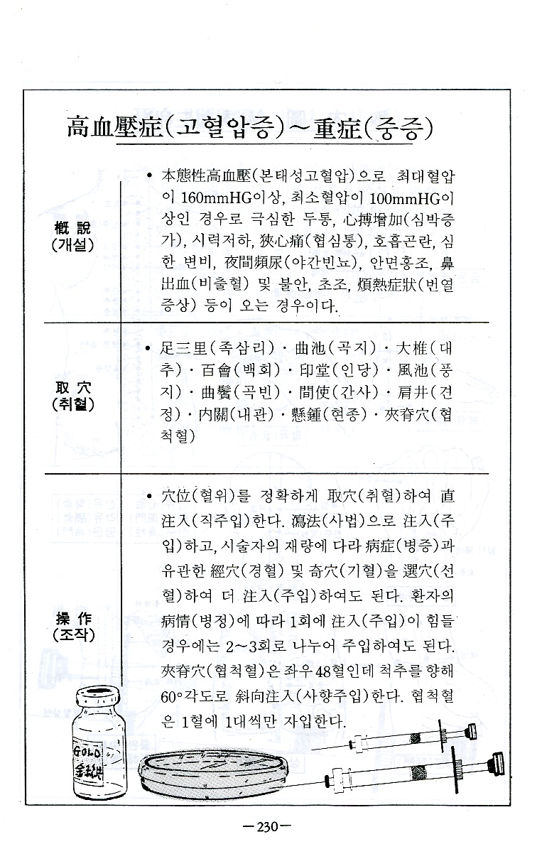 금침의비방