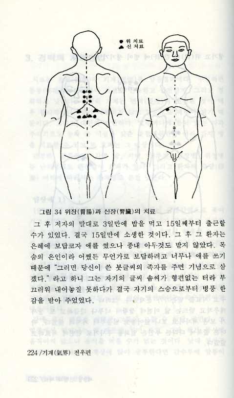 면역과기의세계1