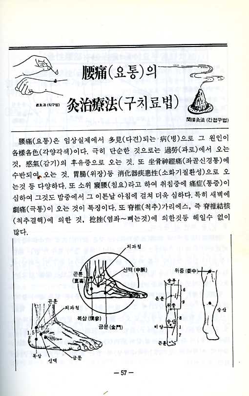 요통의침구치료