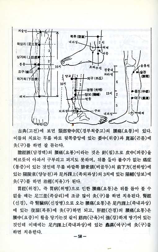 요통의침구치료