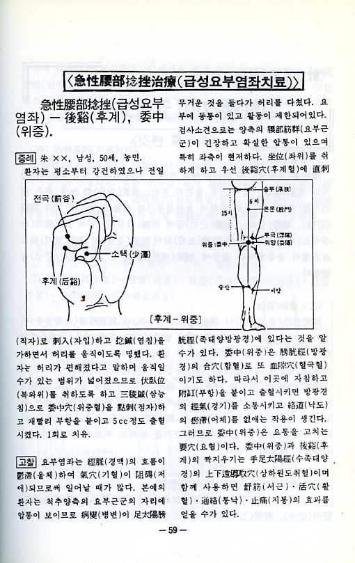 요통의침구치료