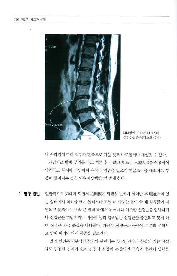 약실자입요법