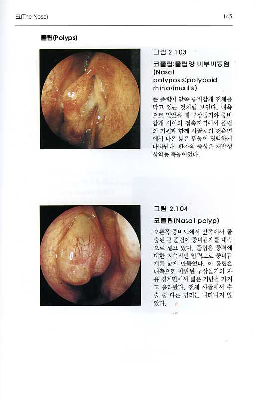 Diagnostic Handbook of Otorhinolaryngology