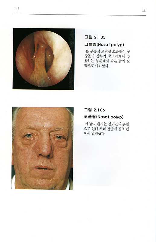 Diagnostic Handbook of Otorhinolaryngology