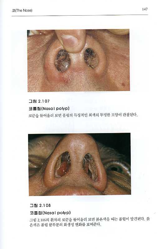 Diagnostic Handbook of Otorhinolaryngology