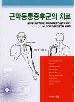 근막동통증후군의치료