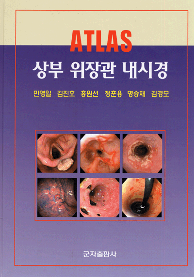 상부 위장관 내시경 ATLAS