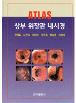 상부 위장관 내시경 ATLAS