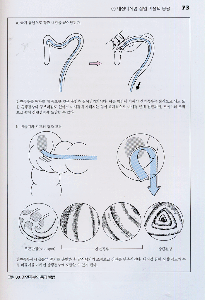 대장내시경삽입법 [초보자에서 숙련자까지]