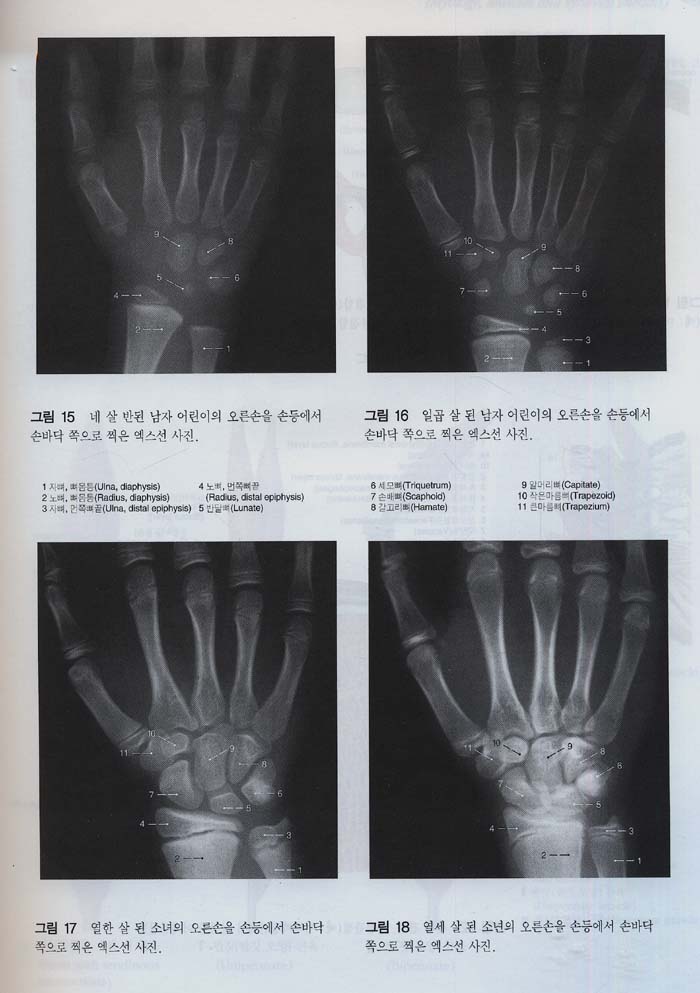 Sobotta 원색인체해부학 2Vols 13판번역