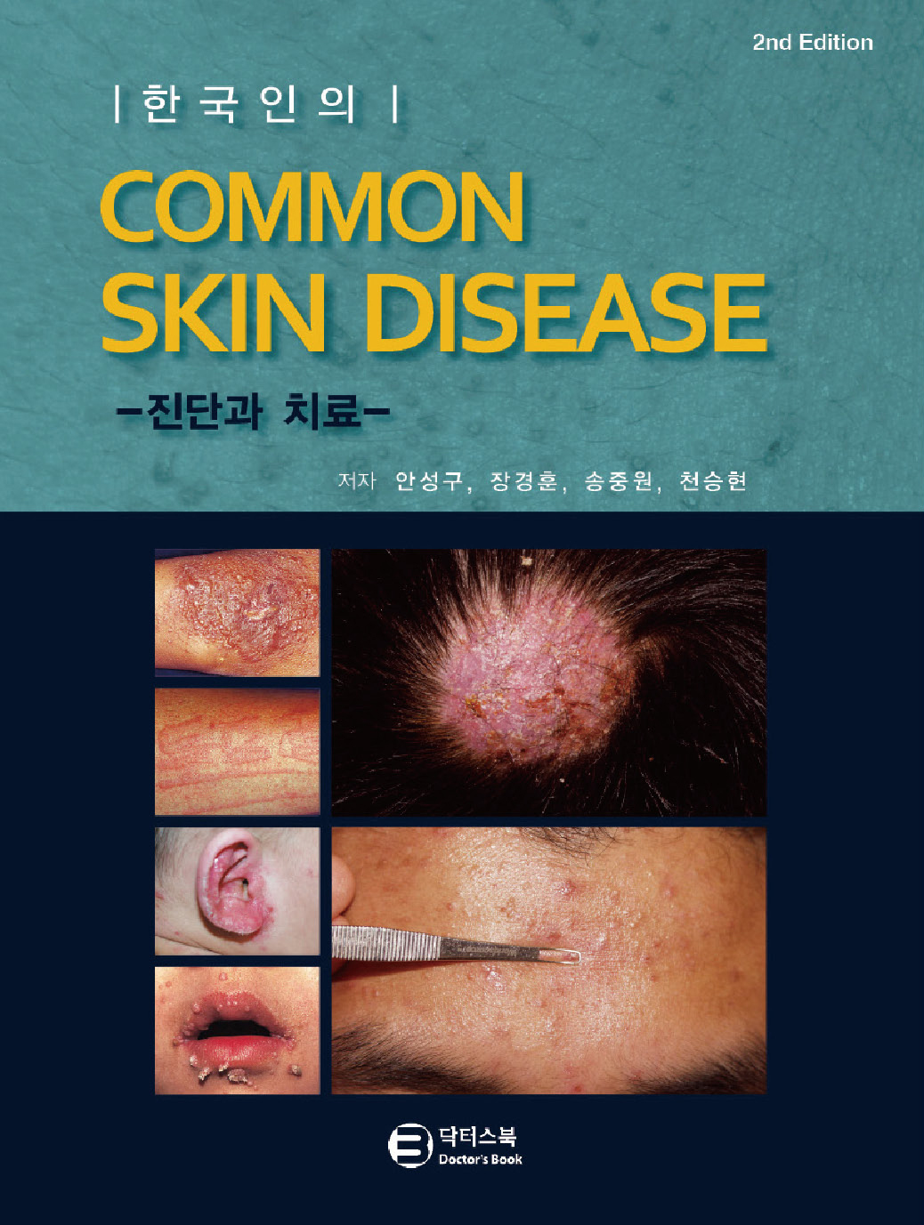 한국인의 흔히보는 피부질환 common skin disease 2판