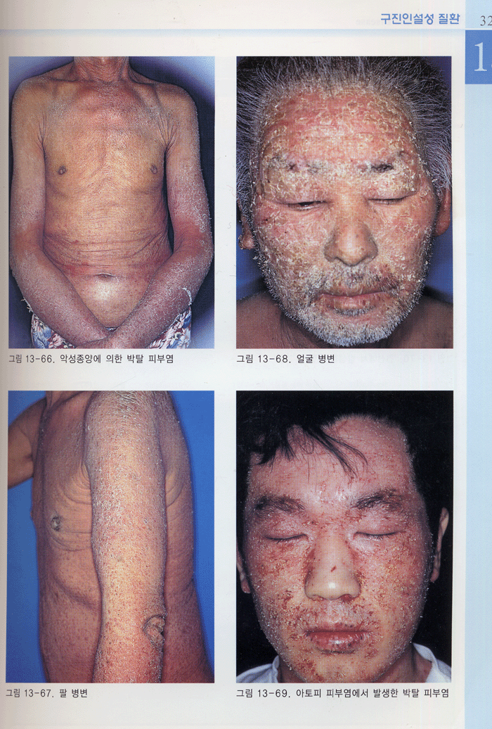 한국인의 흔히보는 피부질환 common skin disease 2판