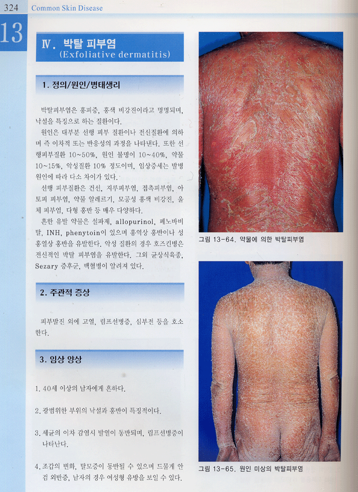 한국인의 흔히보는 피부질환 common skin disease 2판