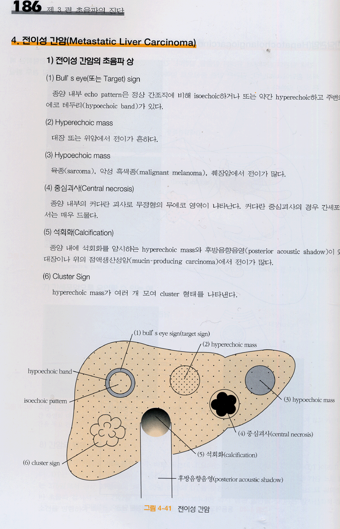 초음파 진단의 이해 ( 둘째판)