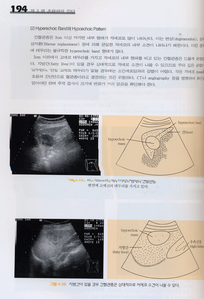 초음파 진단의 이해 ( 둘째판)