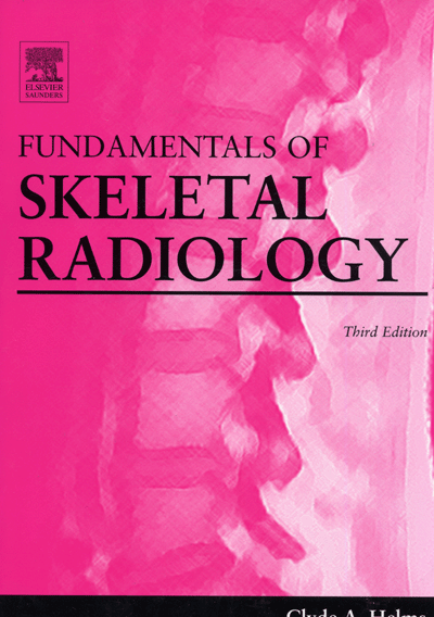 Fundamentais of Skeletal Radiology 3th