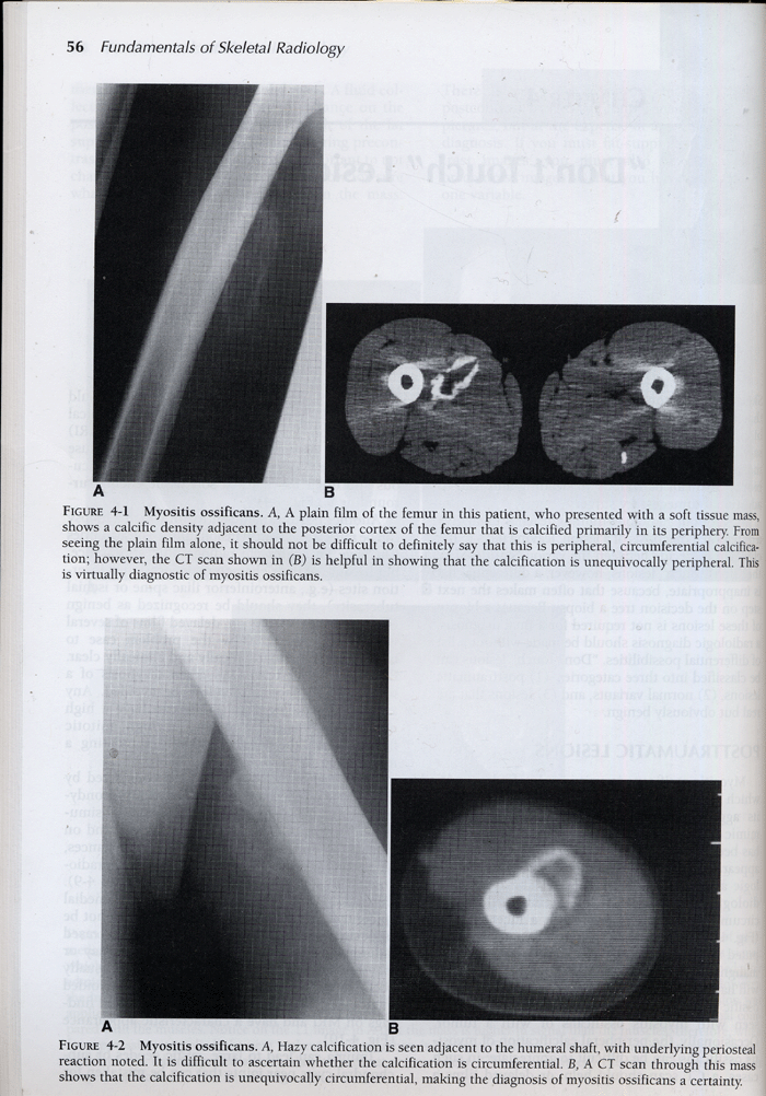 Fundamentais of Skeletal Radiology 3th