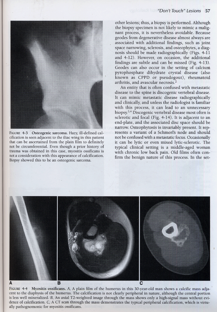 Fundamentais of Skeletal Radiology 3th