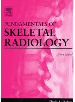 Fundamentais of Skeletal Radiology 3th