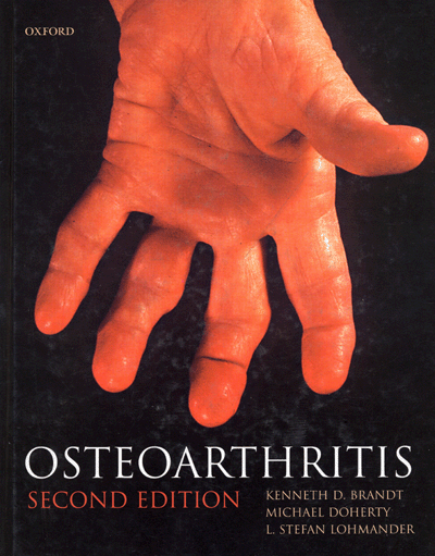 Osteoarthritis 2th