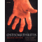 Osteoarthritis 2th