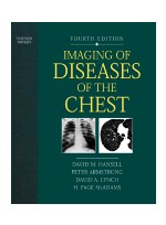 lmaging of Diseases of the Chest 4th