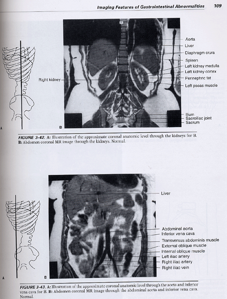 Radiology 101 The Basics and Fundamentals of Imaging ,2/e