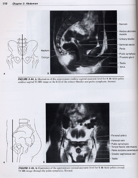 Radiology 101 The Basics and Fundamentals of Imaging ,2/e